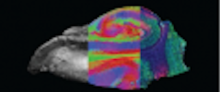 Maria Ly's Artwork is on the cover Human Brain Mapping